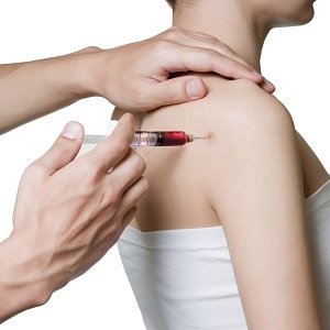 Platelet-Rich Plasma (PRP) Injection